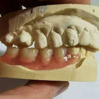 为什么海外牙科老板，开始找中国深圳义齿工厂合作？